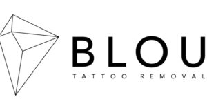 Blou Tattoo Removal