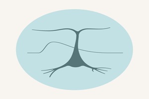 Centro enfermedades y especialidades neurologicas Dr Molina Arjona clínicas de apnea del sueño en Madrid